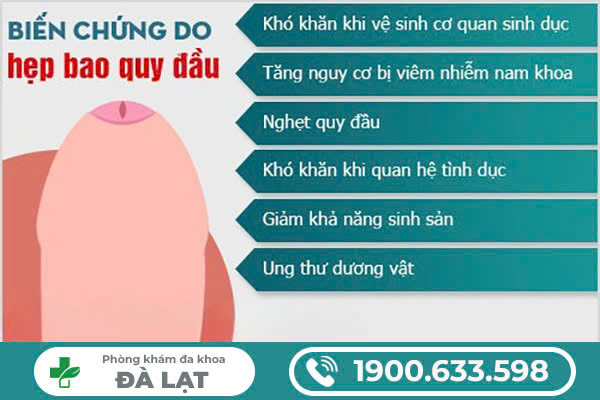 Hình ảnh minh họa